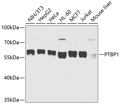 PTBP1 Rabbit Polyclonal Antibo