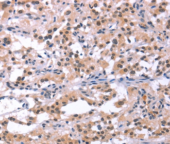 ORAI1 Antibody[37133]