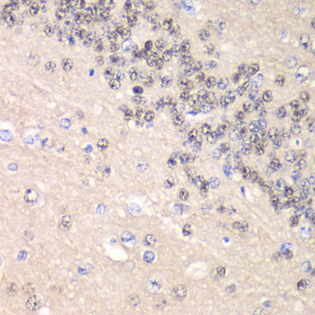 CCNC antibody[38997]