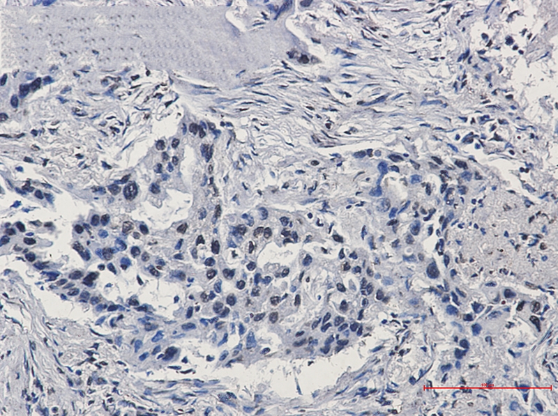 HIF1 beta Rabbit mAb[52771]