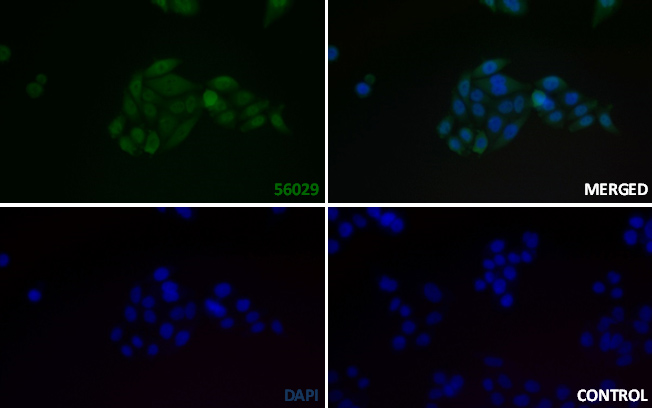 TRAM2 Rabbit mAb[56029]