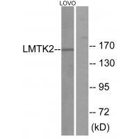 LMTK2 Antibody[33961]