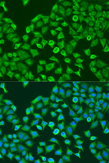 PUM1 Rabbit Polyclonal Antibod