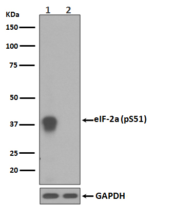 eIF2 alpha (Phospho-Ser51) Rab