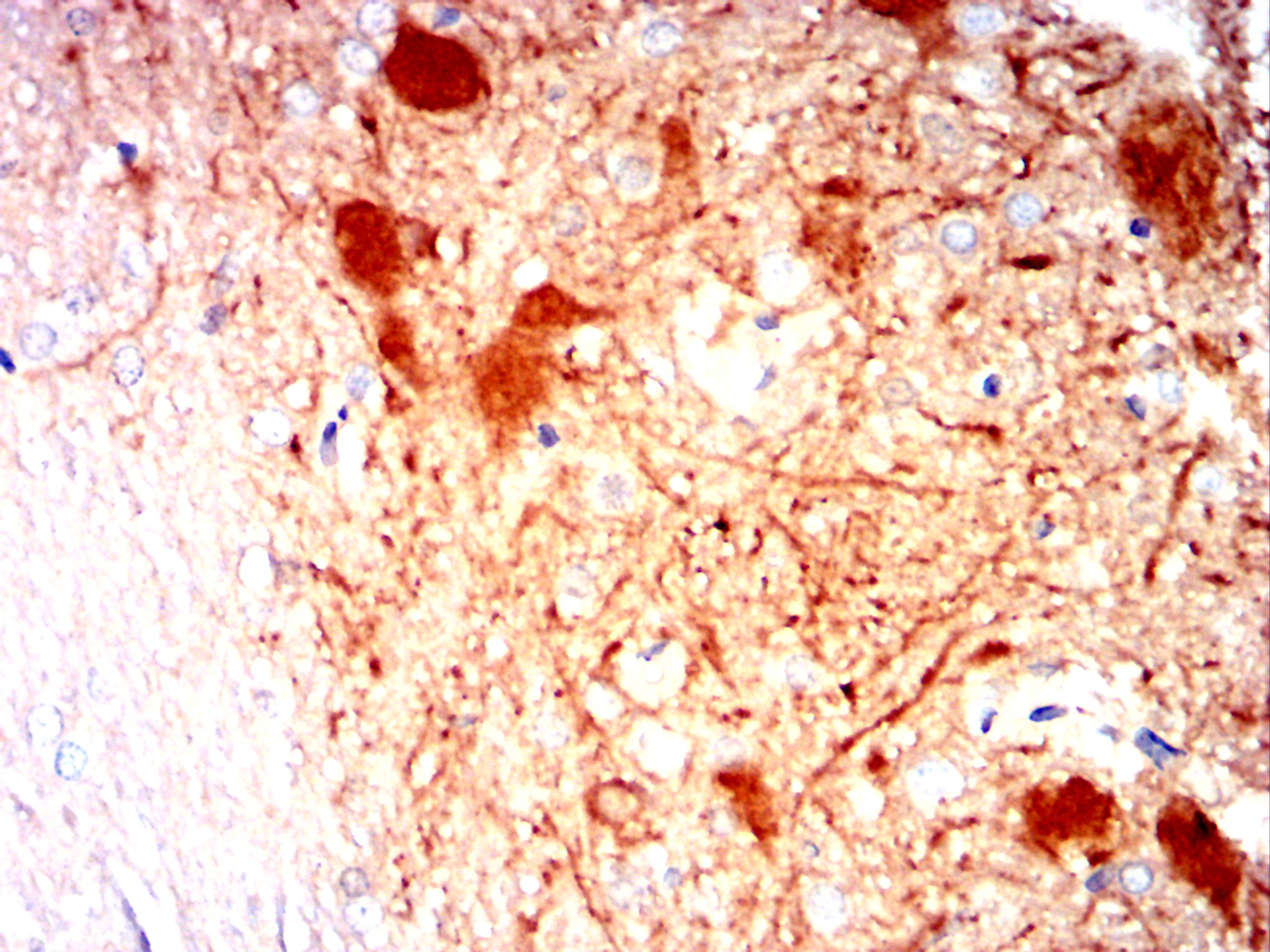 CAMK2G Mouse mAb[63190]