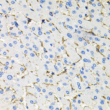 SSTR2 antibody[38600]