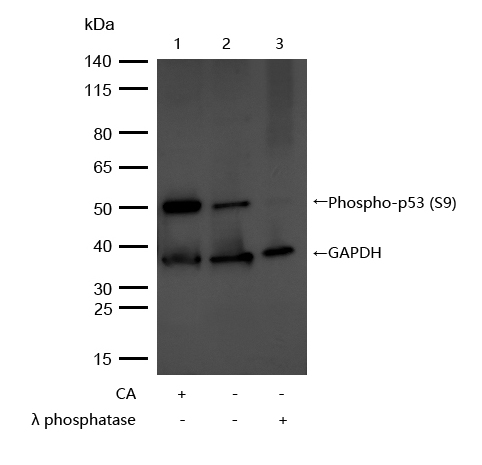 p53 (Phospho-Ser9) Rabbit mAb[