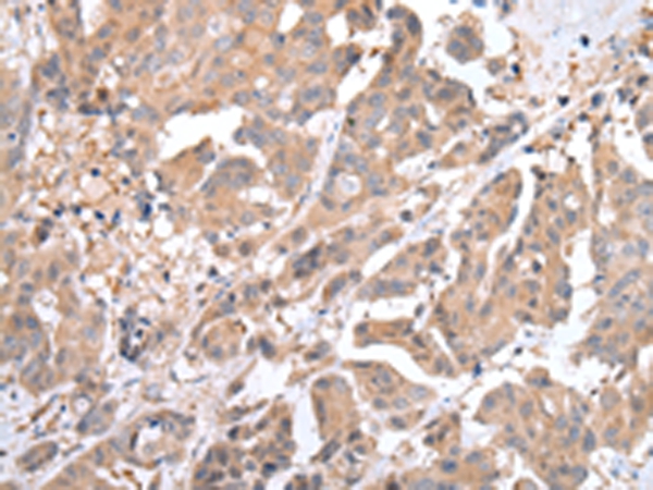 ACVRL1 Antibody[43246]