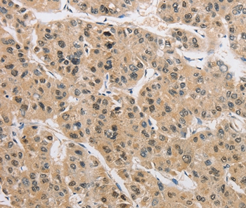 AMZ2 Antibody[36126]