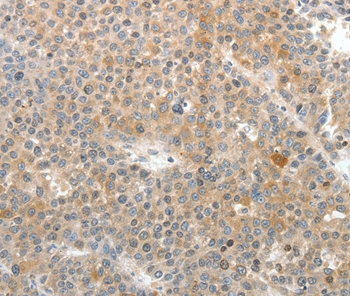 SV2A Antibody[37263]