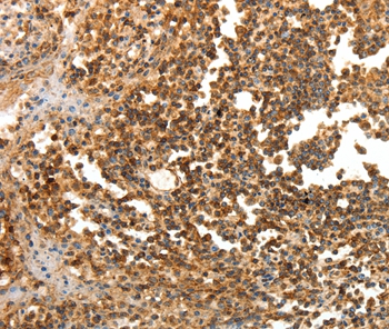 LRP12 Antibody[35802]