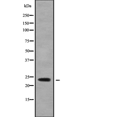ATP5O Antibody[45787]