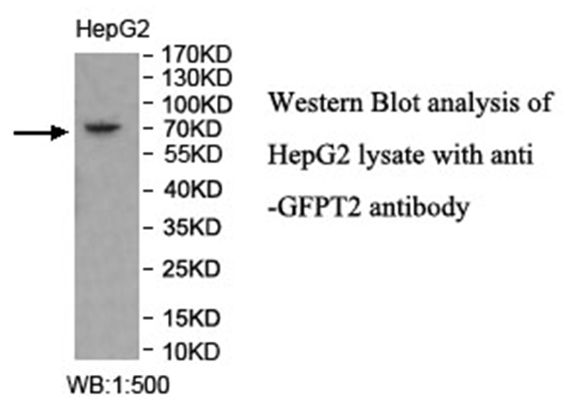GFPT2 Antibody[40023]