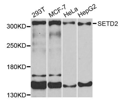 SETD2 antibody[38633]