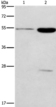 GABRG2 Antibody[37584]