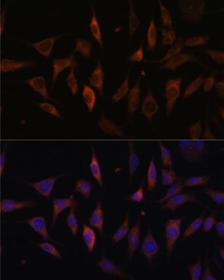 MT-ND1 Rabbit Polyclonal Antib