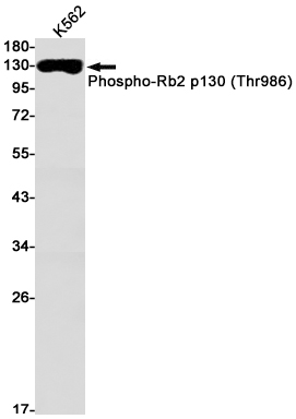 Phospho-Rb2 p130 (Thr986) Rabb