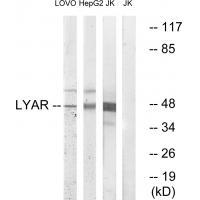 LYAR Antibody[34561]