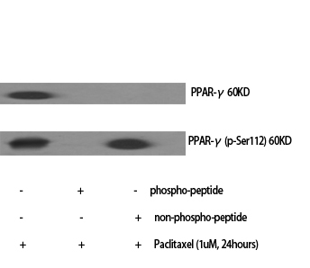 PPAR-γ Polyclonal Antibody[413