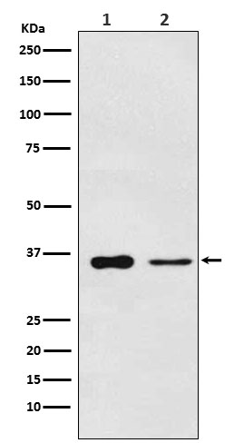 PDLIM1 Rabbit mAb[56785]