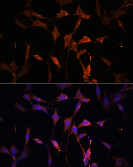 KEAP1 Rabbit Polyclonal Antibo