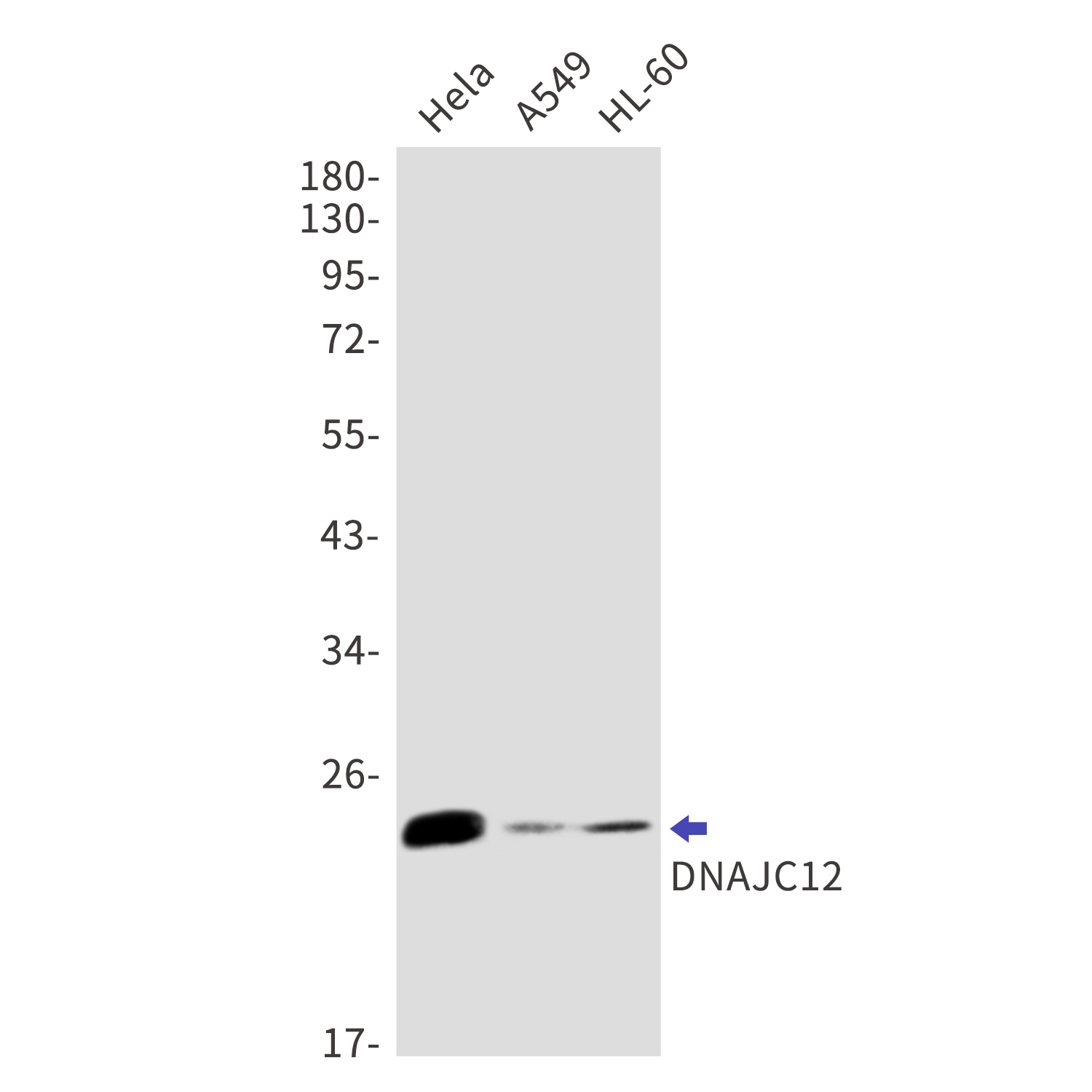 DNAJC12 Rabbit mAb[52751]