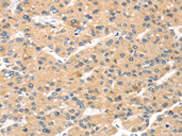 MAGEA11 Antibody[43138]