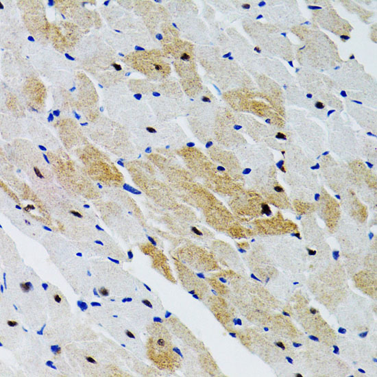 PTPN11 antibody[38468]