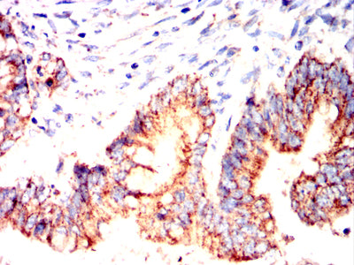 MUC13 Mouse mAb[63966]