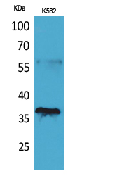 CD207 Polyclonal Antibody[4168