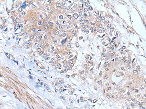 MIEN1 Antibody[43804]