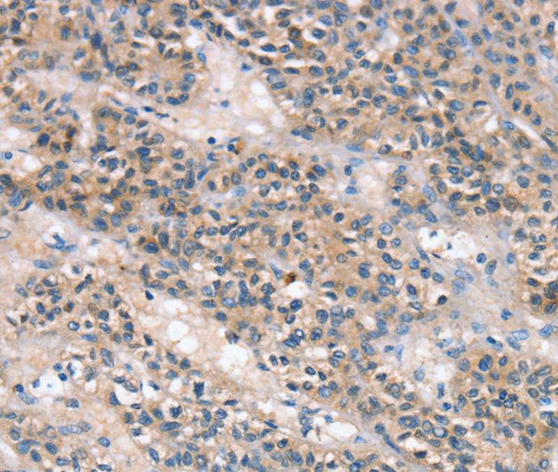 SLC25A1 Antibody[40107]