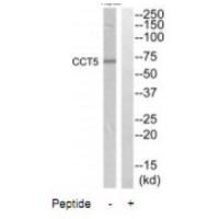 CCT5 Antibody[35090]