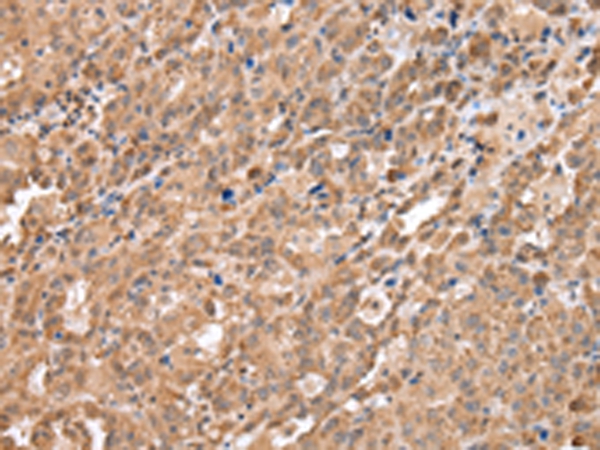 DDX58 Antibody[43258]