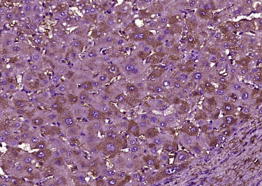 High density lipoprotein Antib