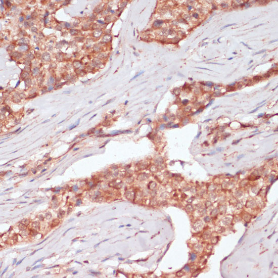 ACAT2 Rabbit Polyclonal Antibo