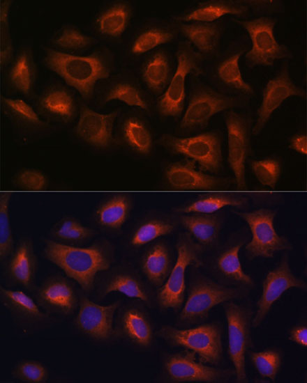 ARFGAP2 Rabbit Polyclonal Anti
