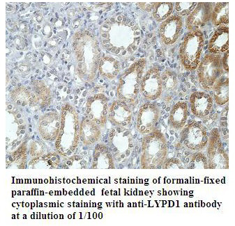 LYPD1 Antibody[39909]