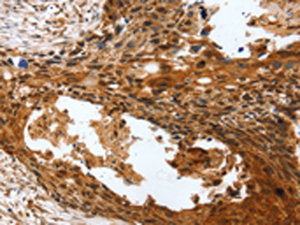 PTX3 Antibody[43163]