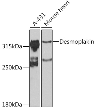 Desmoplakin Rabbit Polyclonal 