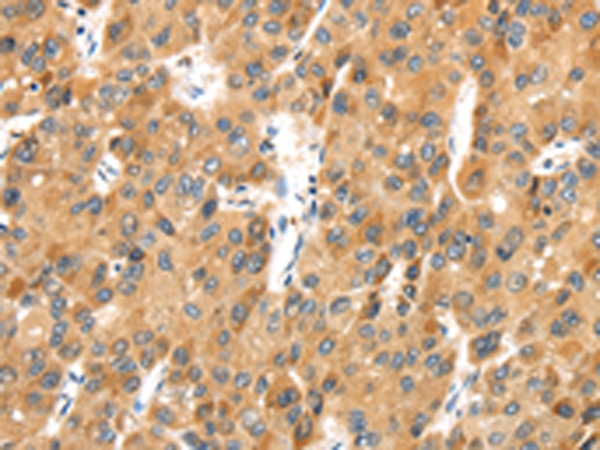 MACC1 Antibody[43136]
