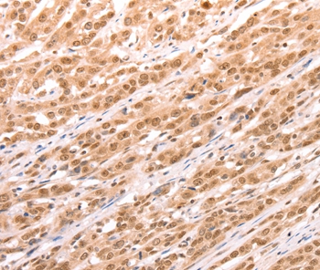 TAX1BP1 Antibody[35972]