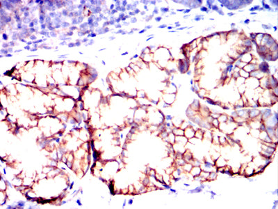 CD82 Mouse mAb[63424]