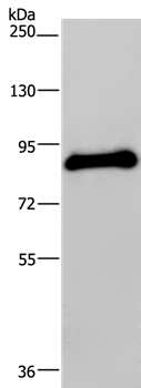POMT1 Antibody[37839]