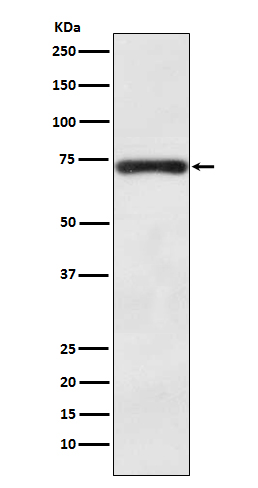 BACE1 Rabbit mAb[56173]