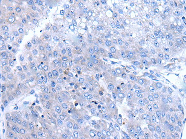 BTG4 Antibody[43501]