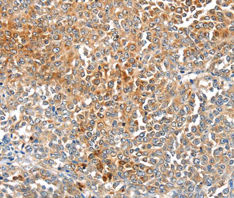 MAGEB2 Antibody[40202]