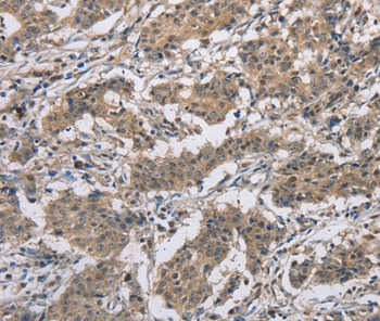 DSG2 Antibody[36413]