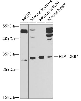 HLA-DRB1 Rabbit Polyclonal Ant