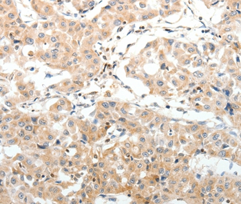 SV2A Antibody[37263]